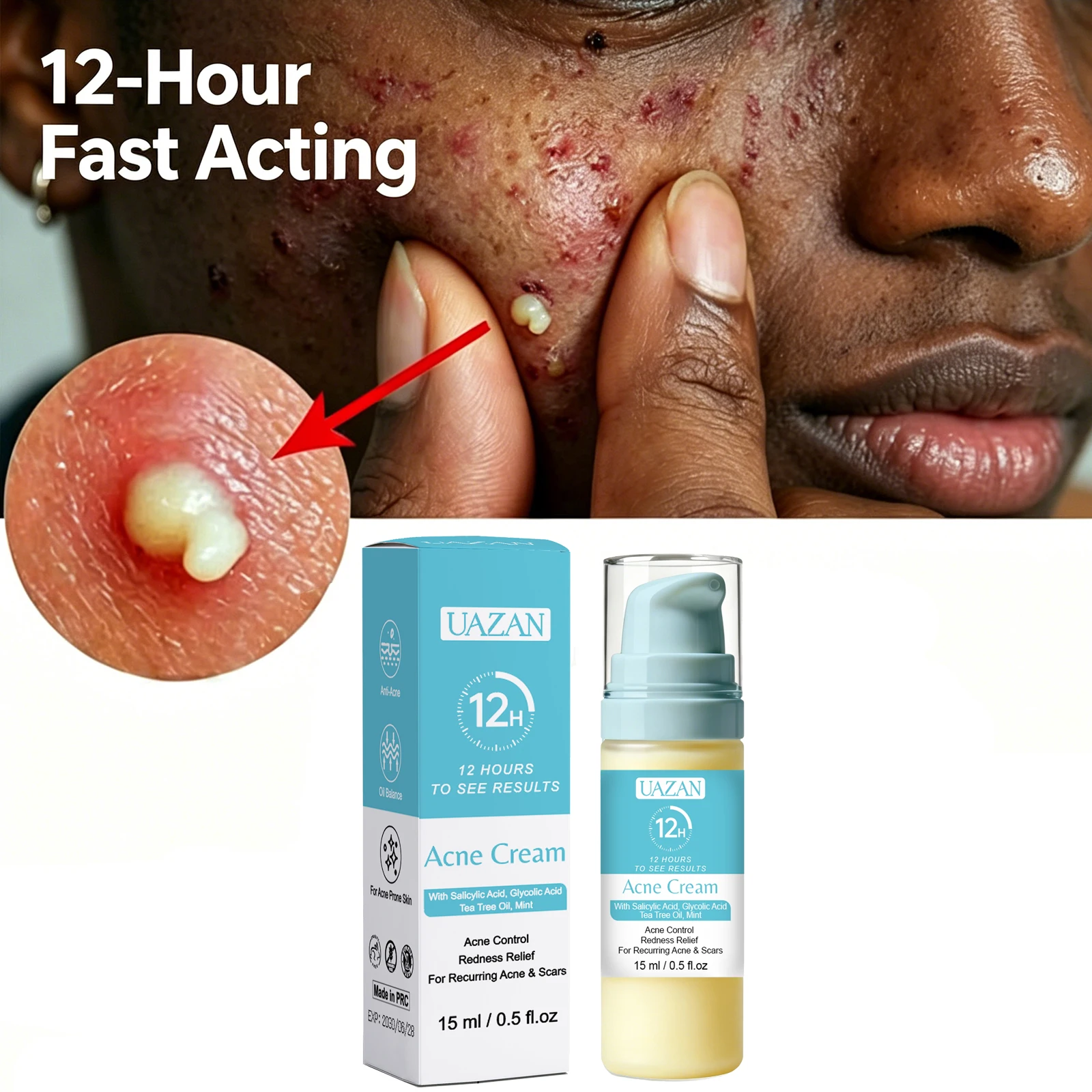 Crème Anti-Acné Acide Salicylique – Efface Cicatrices, Taches & Resserre les Pores