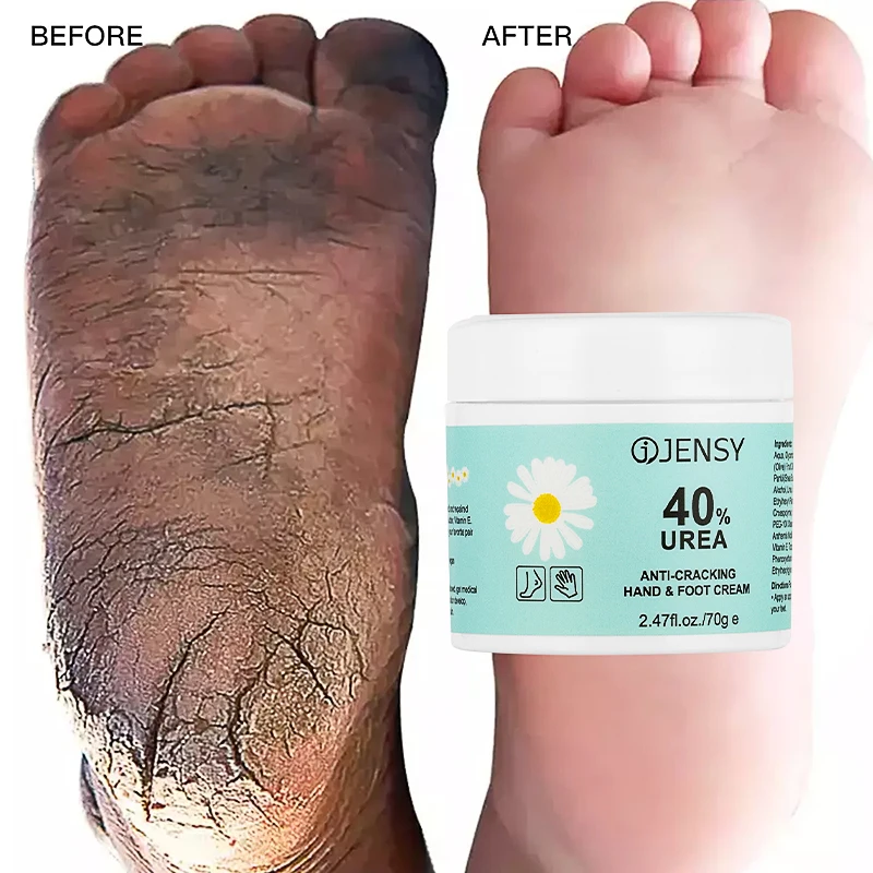 Crème Pieds Talons Fendillés 40% Urée – Exfoliante Réparatrice & Hydratante 70g