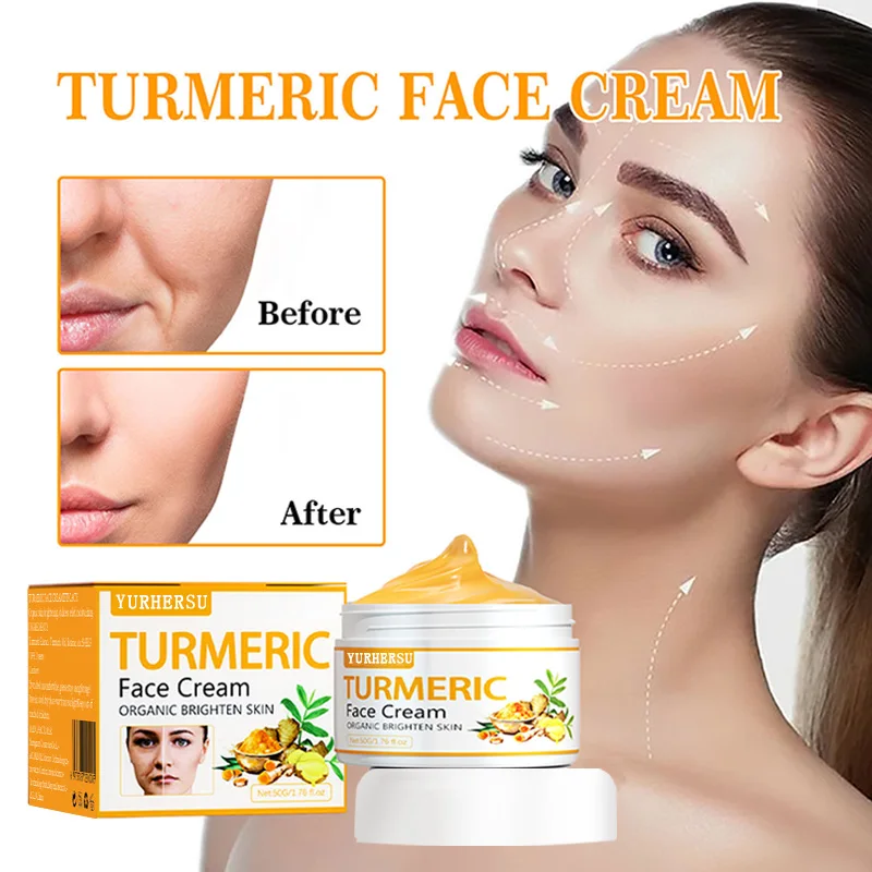 Crème Visage au Curcuma – Anti-Acné, Éclaircissante & Hydratante 50ml
