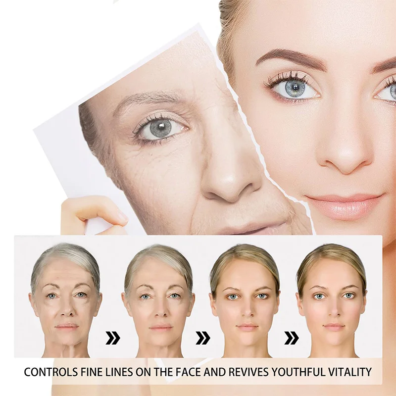 Crème Visage au Curcuma – Anti-Acné, Éclaircissante & Hydratante 50ml