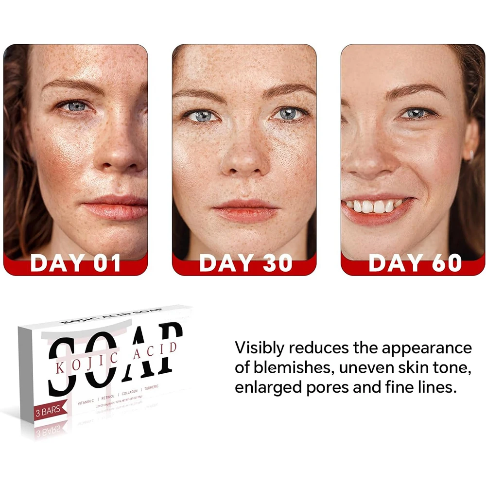 Savon Artisanal Curcuma & Acide Kojique – Éclaircissant, Hydratant, Visage & Corps
