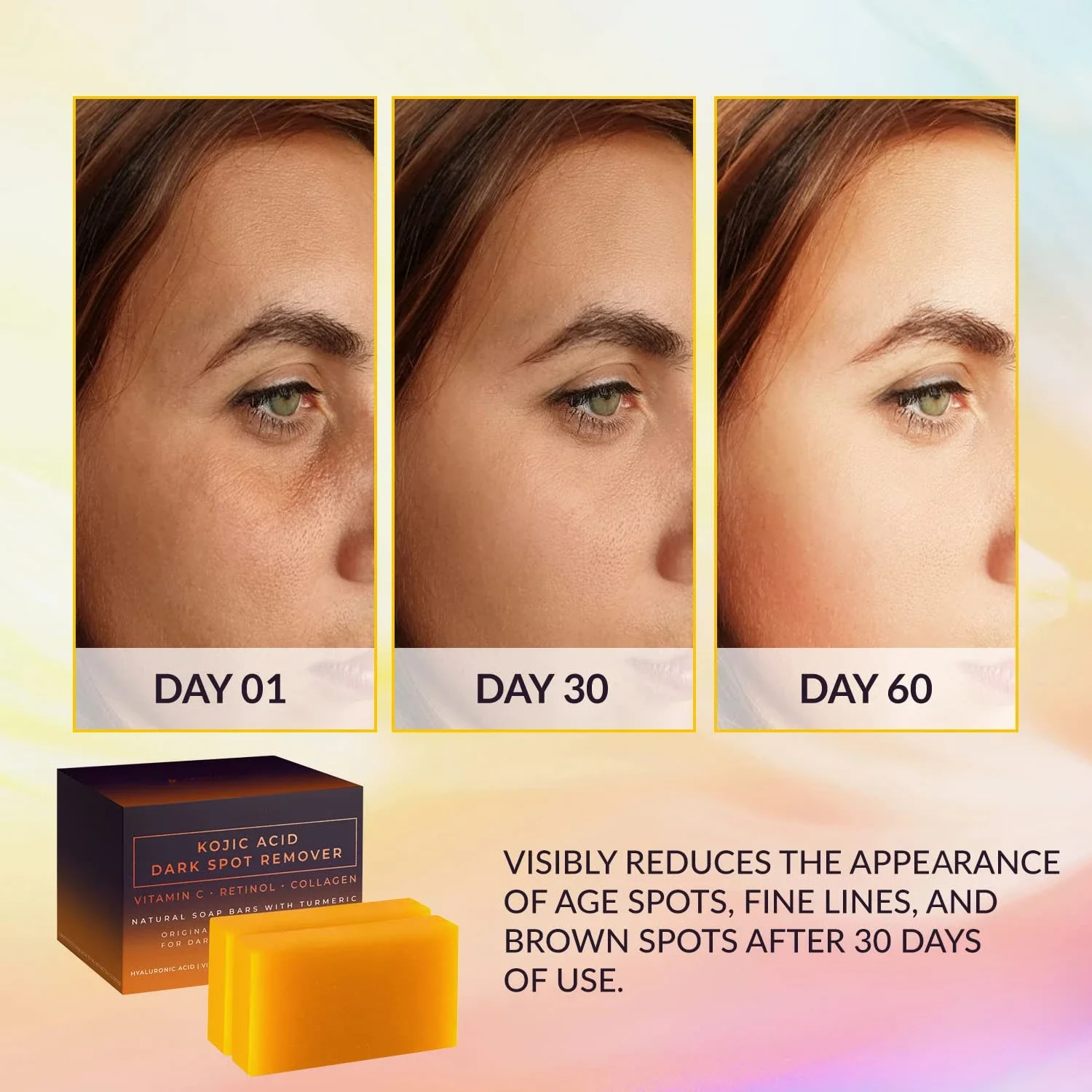 Savon Éclaircissant Acide Kojique – Vitamine C, Rétinol & Curcuma | Visage & Corps