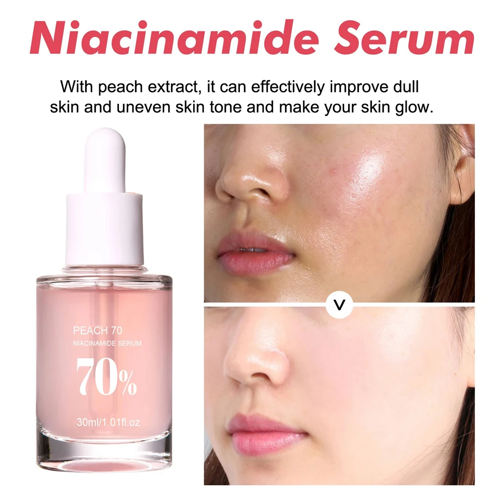 Sérum Visage Niacinamide 30ml – Éclat, Hydratation & Resserrement des Pores