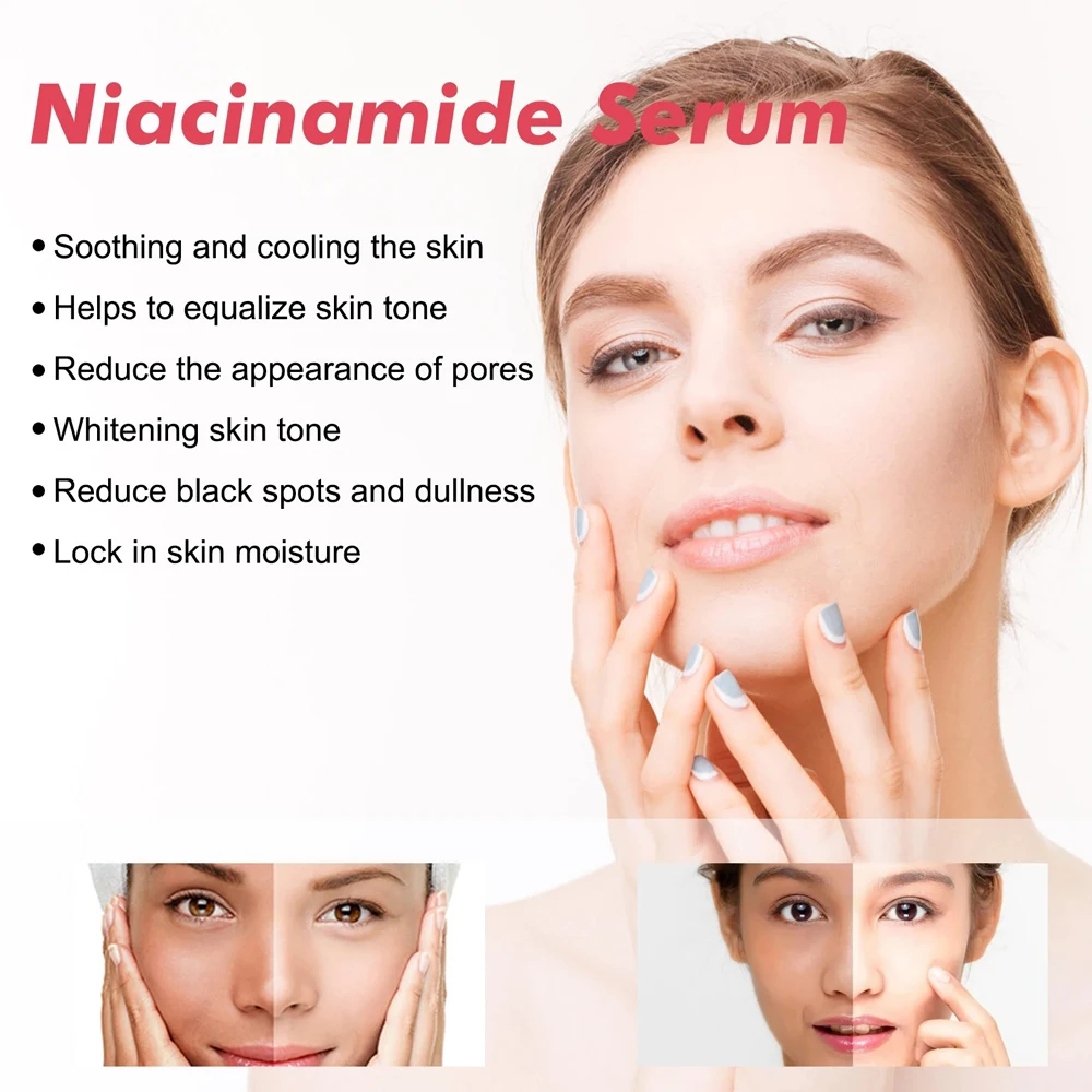 Sérum Visage Niacinamide 30ml – Éclat, Hydratation & Resserrement des Pores