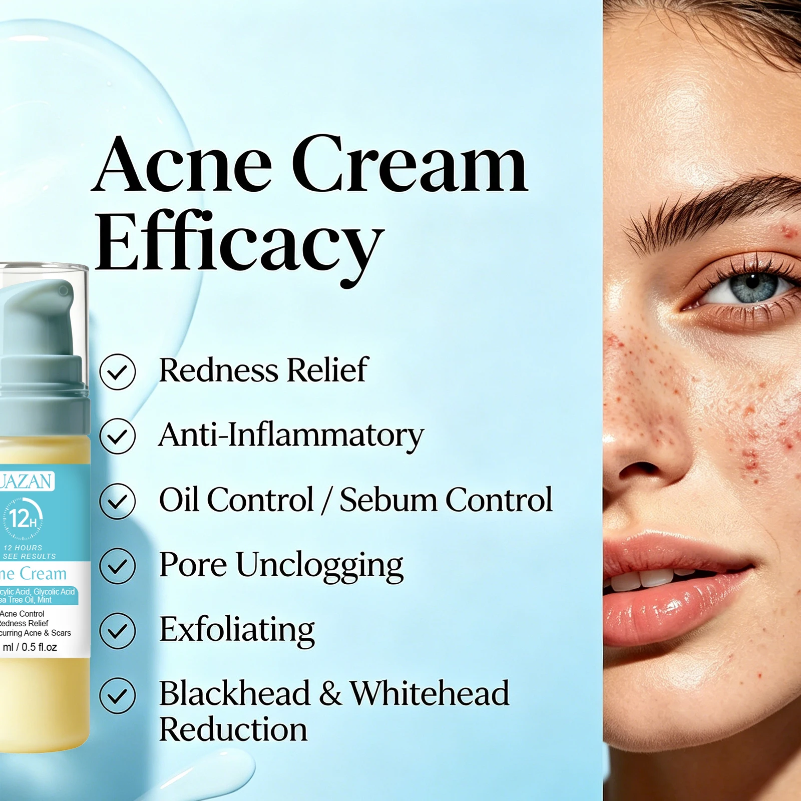 Crème Anti-Acné Acide Salicylique – Efface Cicatrices, Taches & Resserre les Pores