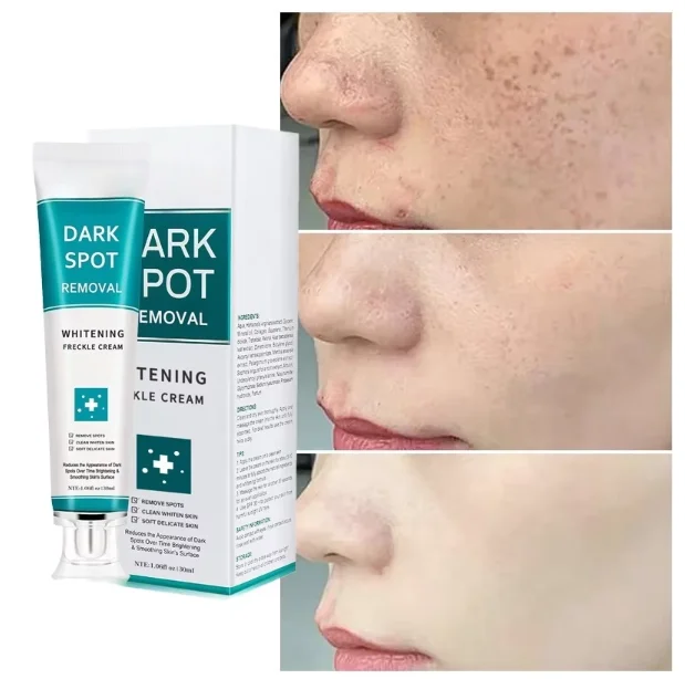 Crème Éclaircissante Visage & Corps – Vitamine C, Anti-Mélanine & Hydratante