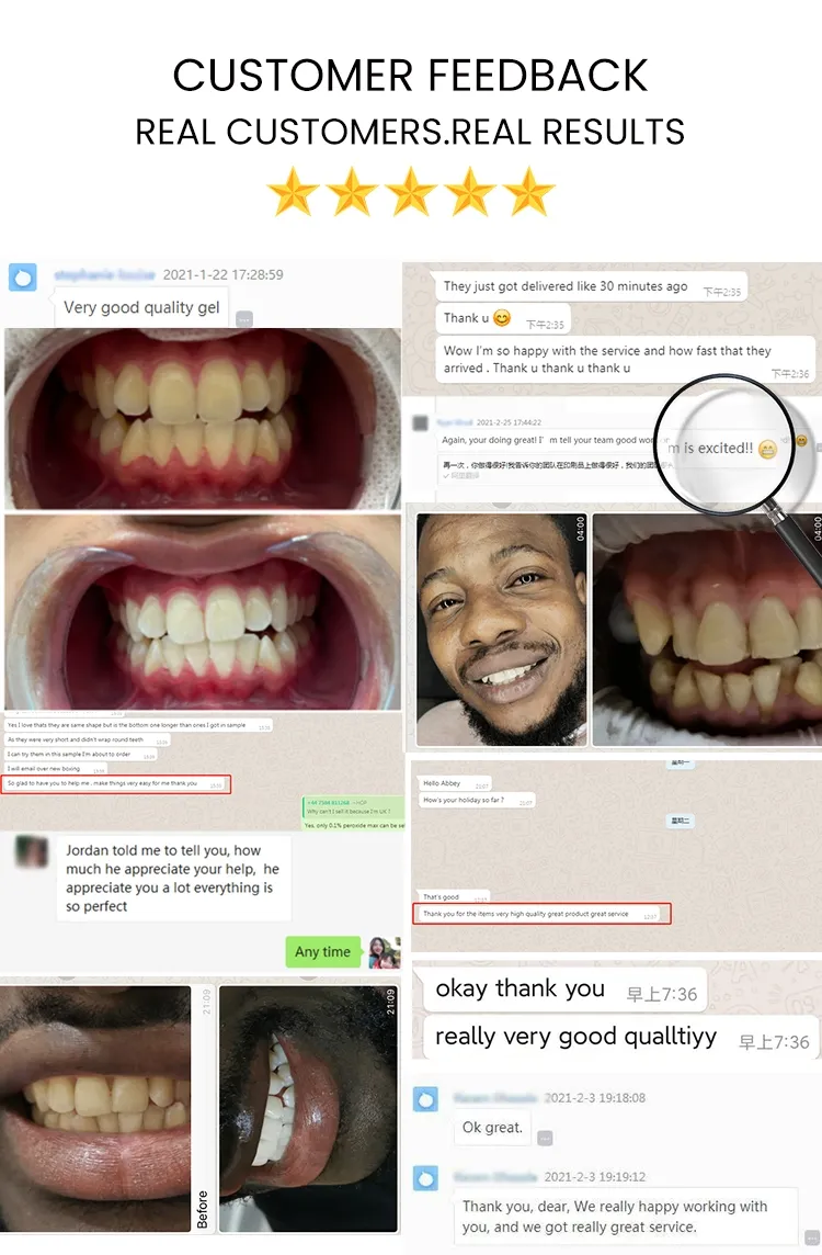 Kit Professionnel de Blanchiment des Dents GlorySmile – LED Bleue Rechargeable + 3 Gels Blanchissants – Système à Domicile avec Logo Personnalisable