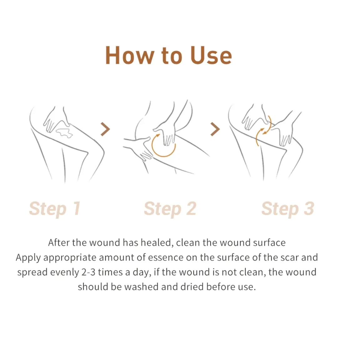 LANBENA Sérum Anti-Acné et Anti-Cicatrices