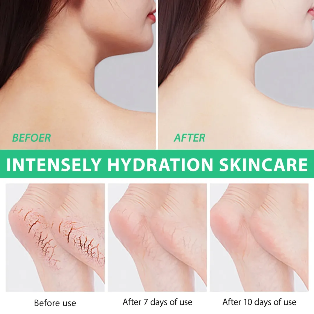 Crème pour les pieds hydratante à l'urée 40% et acide salicylique 2%