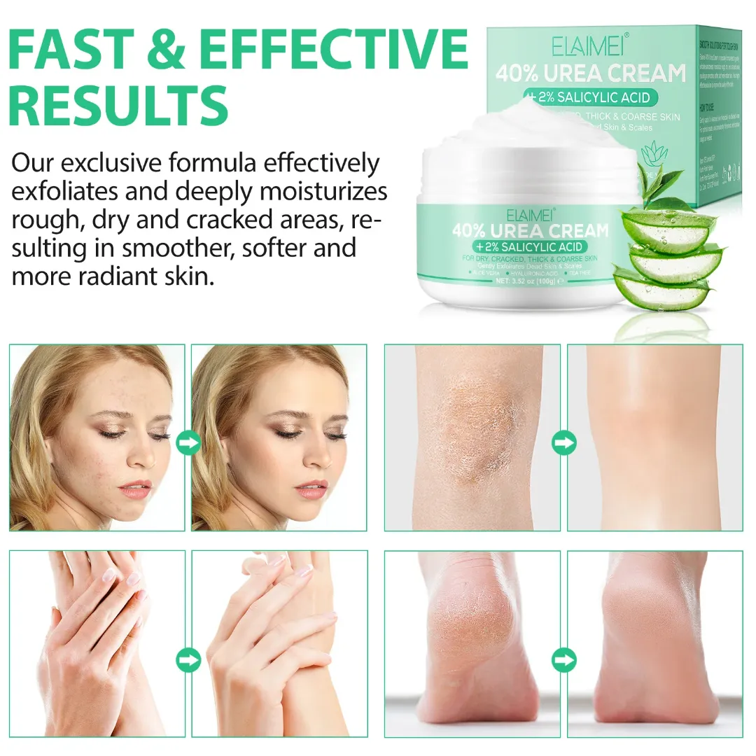 Crème pour les pieds hydratante à l'urée 40% et acide salicylique 2%